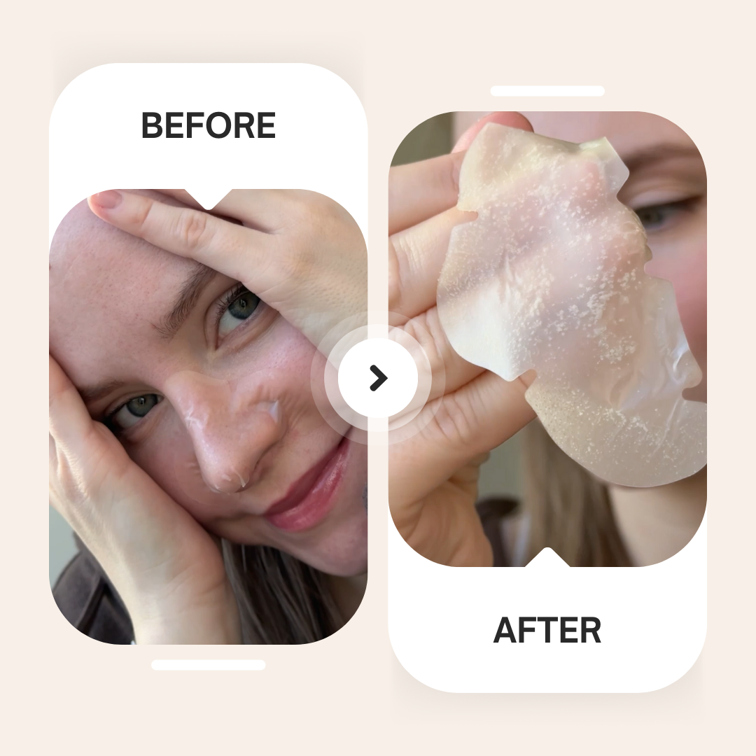 Spotted Pores Hydrocolloid Nose Patches